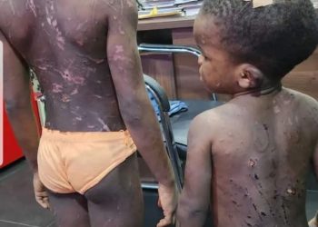 Mother, Lover Held In Lagos For Battering Minors