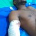 Factory Machine Chops Off Handler’s Forearm In Ogun