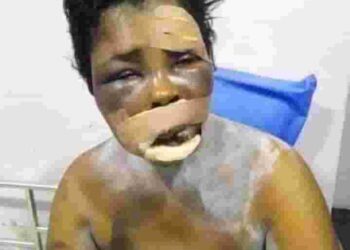 How My ‘Yahoo’ Son Tried To Pluck My Eyes For Money Ritual – Delta Woman