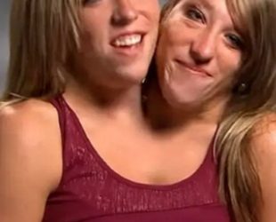 My Sister Aware Whenever My Husband and I Get Intimate – Abby Hensel, Conjoined Twin