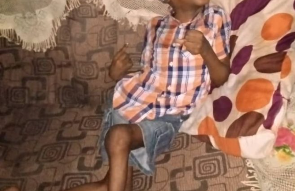 … Pitiable Plight Of 15 – Year – Old Israel Olukayode Who’s Yet To Walk