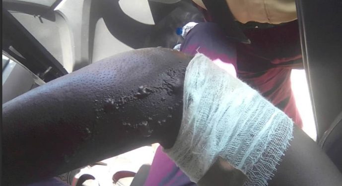 Commercial Bus Driver Evading Arrest, Conductor Set LASTMA Official Ablàze In Lagos