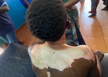 Man Pours Hot Oil On Wife In Ogun, Stabs Her 