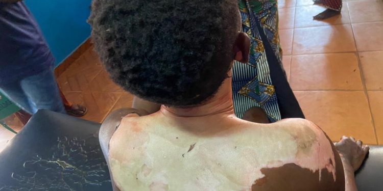 Man Pours Hot Oil On Wife In Ogun, Stabs Her 