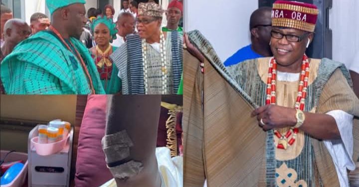 Alaafin, Ooni Supremacy Row: How US-Based Yoruba Monarch Died After Brutal Assault In Oyo 
