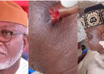 Gov Aiyedatiwa’s Elder Brother Allegedly Severs Part Of Ondo Monarch’s Ear