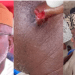 Gov Aiyedatiwa’s Elder Brother Allegedly Severs Part Of Ondo Monarch’s Ear
