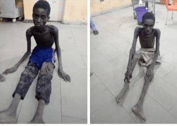 Freed Kidnap Victims Return Severely Emaciated After Days in Bandit Den, Spark Outrage