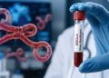 Ebola Scare: FG Begins Tracing, Identifies 44 Close Contacts in FCT