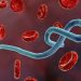Nigeria Identifies ‘Bundibugyo strain’ as First Ebola Case, Infected Patient Battles Multi-Organ Failure