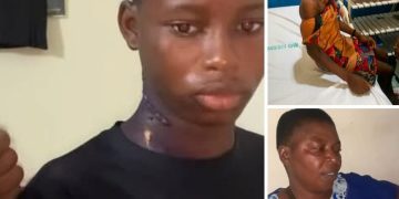 Imo Woman Jailed for Pouring Hot Water on 14-Year-Old Niece