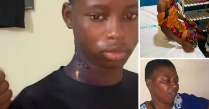 Imo Woman Jailed for Pouring Hot Water on 14-Year-Old Niece 