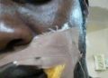 ADC Supporter Shot as Party Leaders’ Convoy Comes Under Attack in Edo