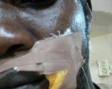 ADC Supporter Shot as Party Leaders’ Convoy Comes Under Attack in Edo